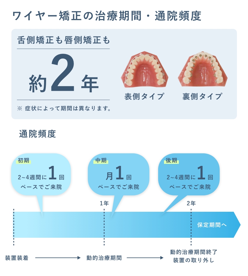 ワイヤー矯正の治療期間と通院間隔