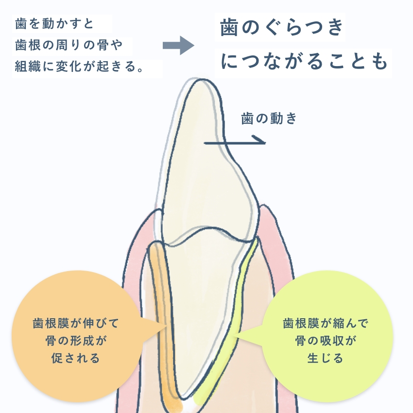 矯正治療で生じる変化