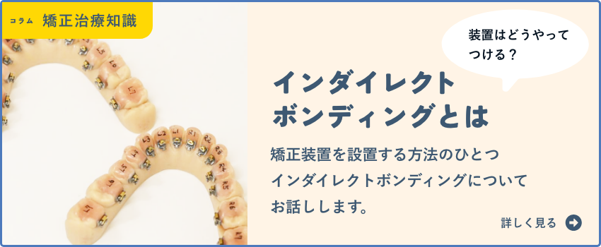 インダイレクトボンディングって