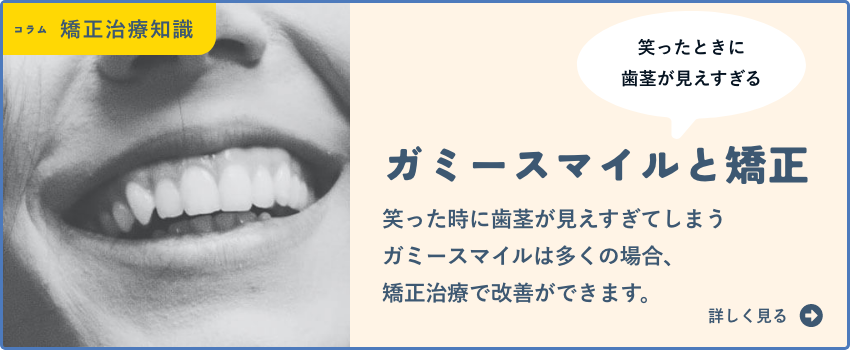 ガミースマイルと矯正治療