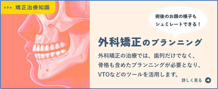 術後の変化もシミュレーションできる外科矯正のプランニングについて