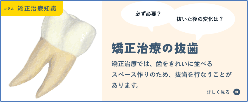 矯正治療の抜歯