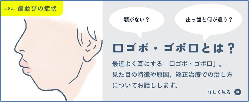 口ゴボ・ゴボ口とは？