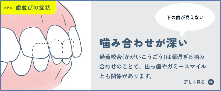 噛み合わせが深い