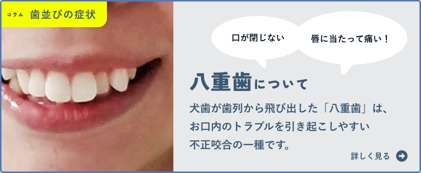 八重歯(やえば)の矯正