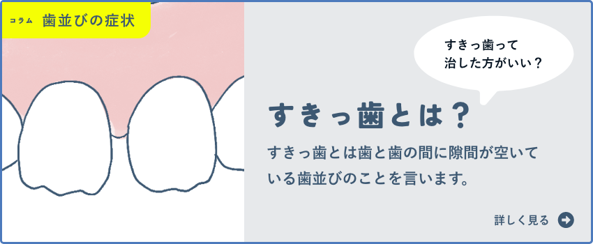 すきっ歯・空隙歯列・正中離開