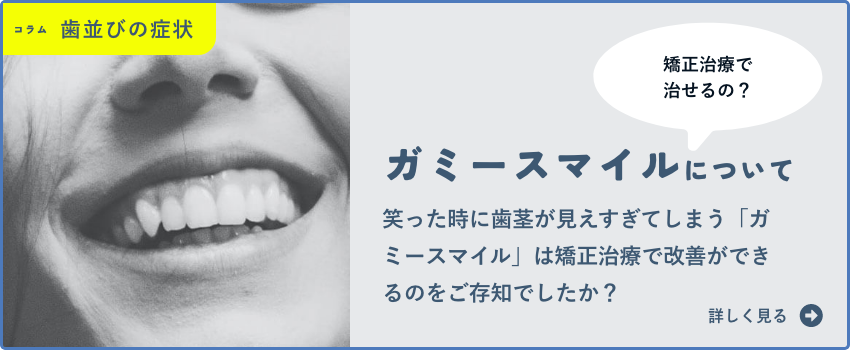 ガミースマイルについて