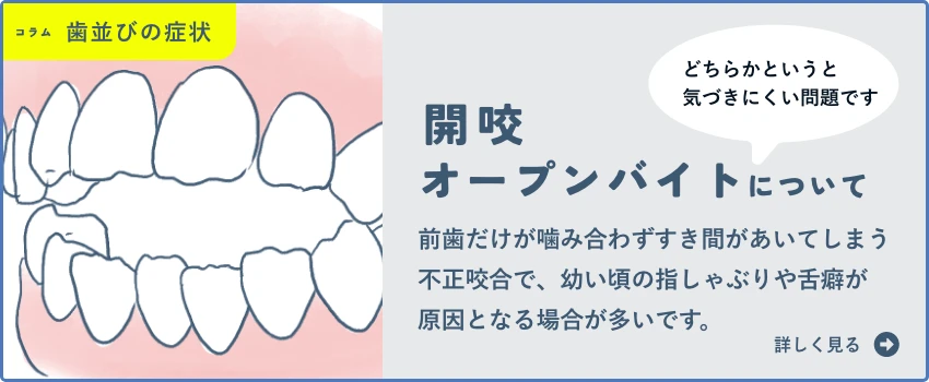 開咬(かいこう)・オープンバイト