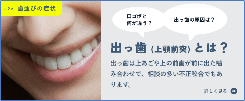 出っ歯(口ゴボ)について