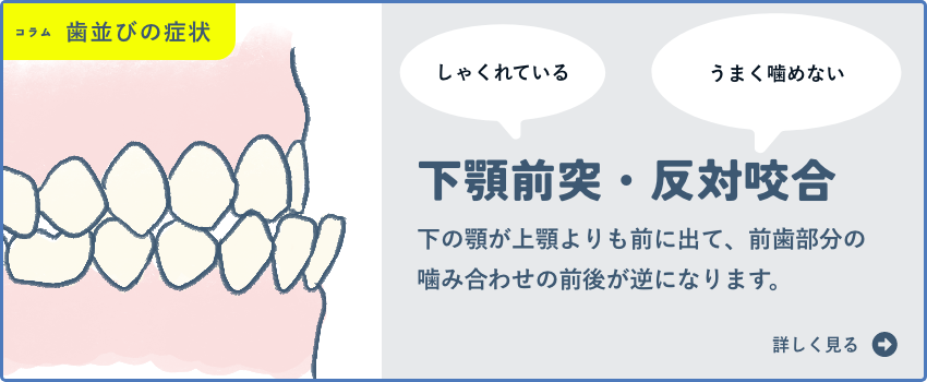 下顎前突・反対咬合・受け口