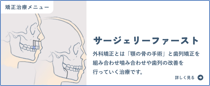 サージェリーファースト