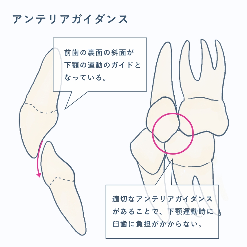 セラミック