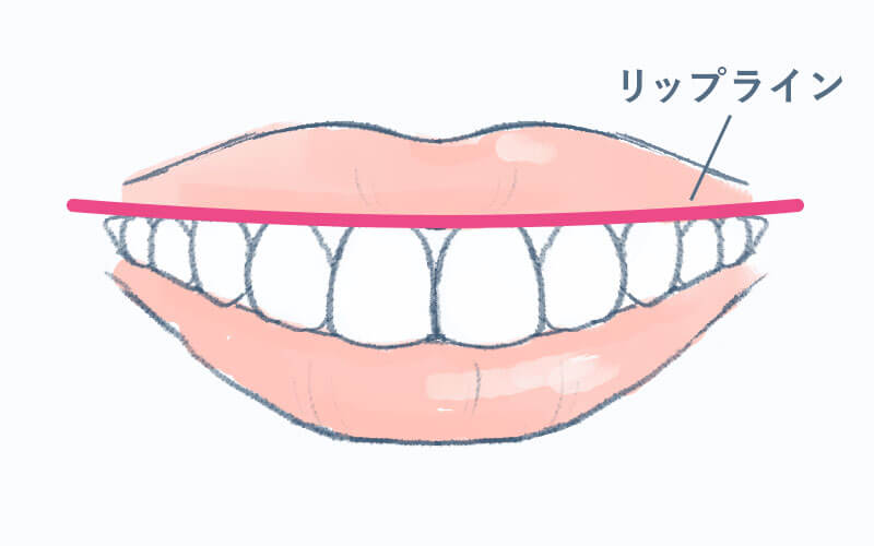 リップライン