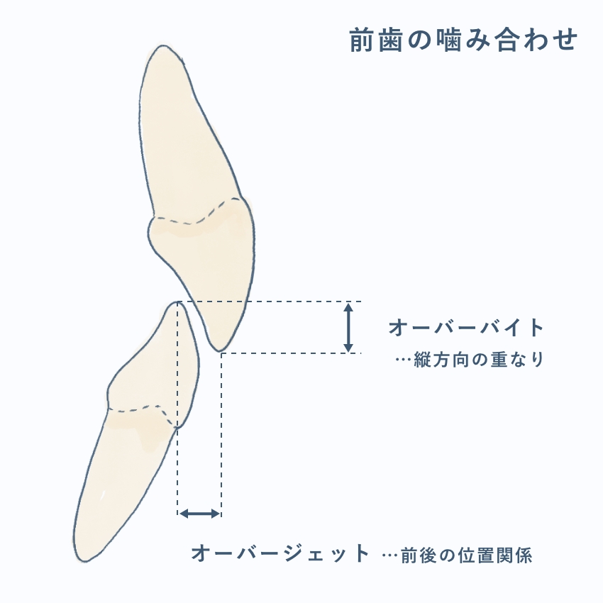 前歯の重なり