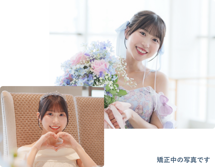 裏側矯正装置をつけてのブライダルフォト