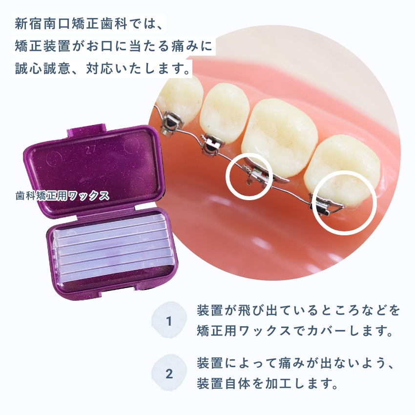 矯正装置が口の中に当たる痛み