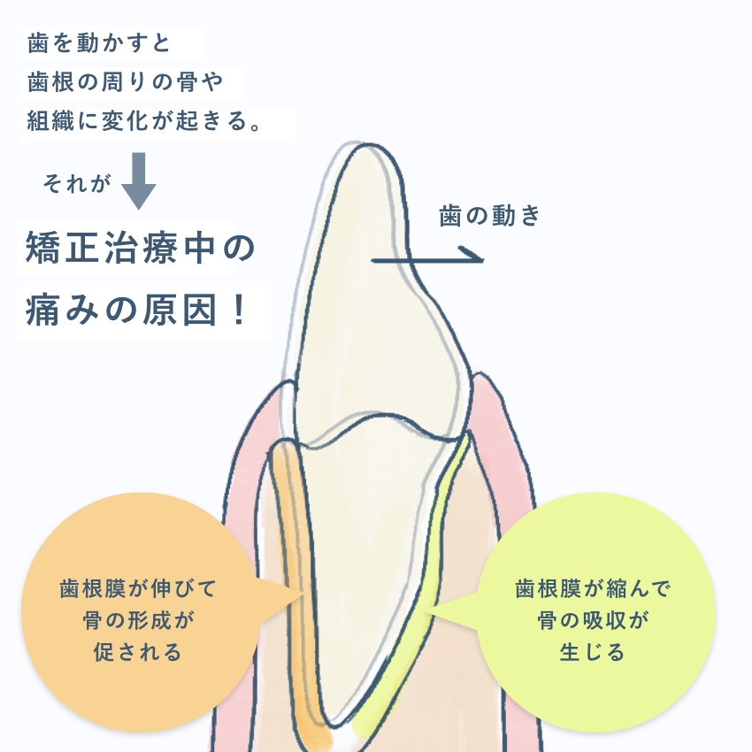 矯正装置が口の中に当たる痛み